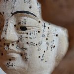 acupuncture