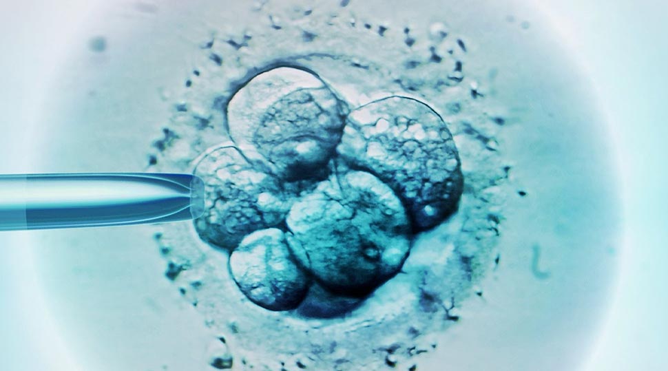 Embryo selection for IVF, light micrograph. (Getty)