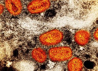 NSW 원숭이 두창 첫 지역 감염 사례 등장 The monkeypox virus can spread through contact with body fluids, sores or items such as clothing and bedding contaminated with the virus. It can also spread from person to person through respiratory droplets, typically in a close setting. (AP)