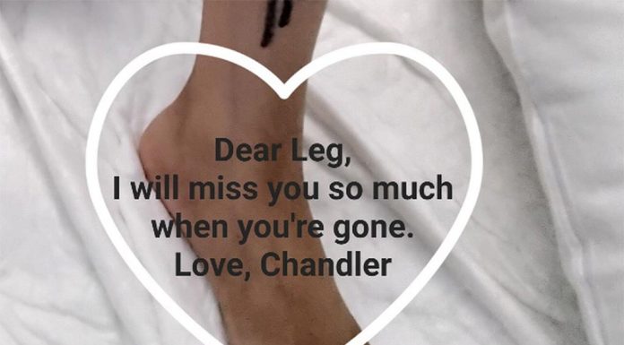 시드니, 희귀암으로 다리를 잃은 소년, 사람들의 작별인사 기다려 Before the amputation, Mr Tran helped his son with an emotional request - saying goodbye to his leg. (Supplied)