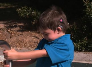 호주 엄마의 세 자녀가 휘말린 인공와우 이식 사고 Kaiysen has been described as a giggly boy - but that's close to the limit of his verbal communication. (9News)