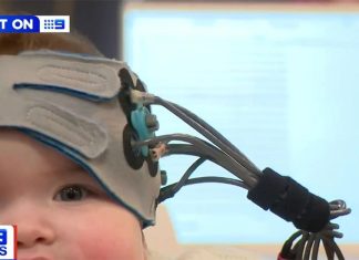 멜번, 청각 장애 신생아의 치료를 돕는 인공와우 발명 The EarGenie was developed by Melbourne's famous Bionics Institute, the organisation behind the cochlear implant. (Nine)