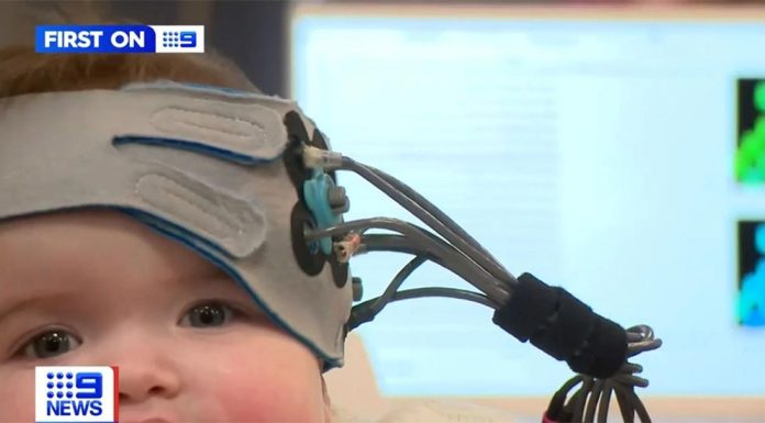 멜번, 청각 장애 신생아의 치료를 돕는 인공와우 발명 The EarGenie was developed by Melbourne's famous Bionics Institute, the organisation behind the cochlear implant. (Nine)