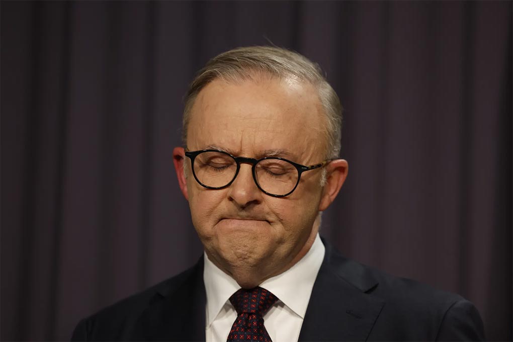Prime Minister Anthony Albanese said the referendum result must be met with grace and humility. CREDITALEX ELLINGHAUSEN