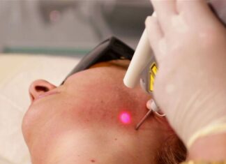 시드니 피부과 전문의, 규제되지 않은 미용 레이저 산업위험성 경고 Dermatologists are concerned the largely unregulated procedure is covering up the signs of something more sinister. (9News)