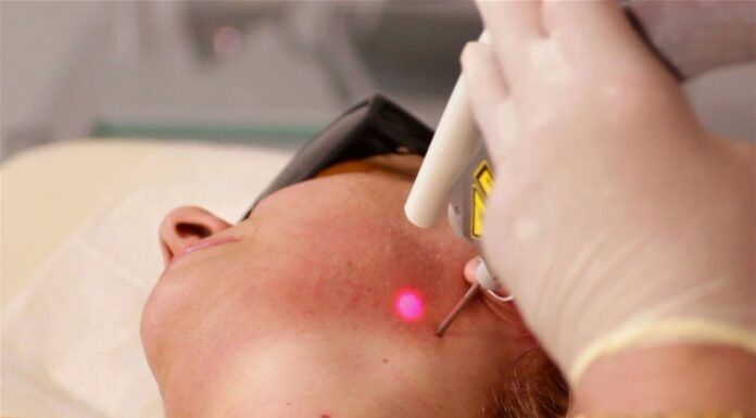 시드니 피부과 전문의, 규제되지 않은 미용 레이저 산업위험성 경고 Dermatologists are concerned the largely unregulated procedure is covering up the signs of something more sinister. (9News)