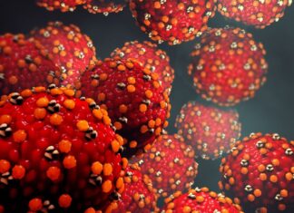 홍역 경보 발령: 감염자 시드니 내 주유소, 양조장, 의료 센터 방문 Measles symptoms can include fever, sore eyes, a cough and rashes. (Getty)