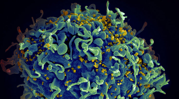 매년 호주인 전립선암으로 3,900명 사망 Unsplash의National Cancer Institute