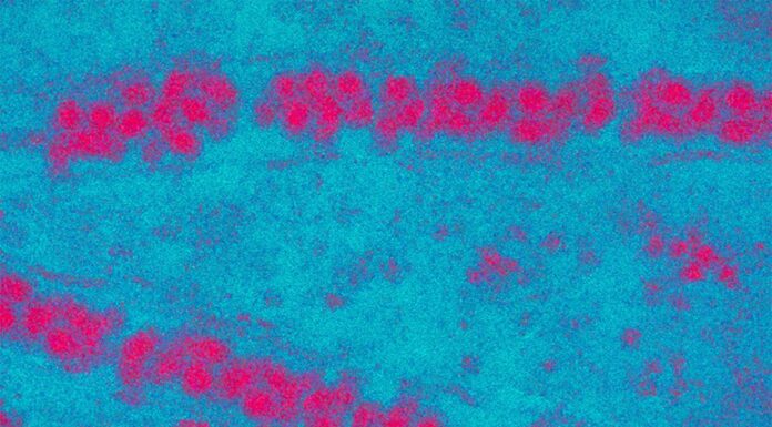 NSW 일본 뇌염을 옮기는 모기 발견, 경고 발령 Japanese encephalitis kills about a quarter of its victims. (Supplied)