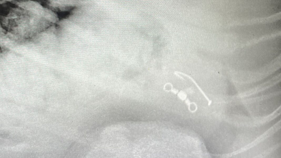 An X-ray shows the fishing hook in Ripley's stomach. (Supplied_9news)