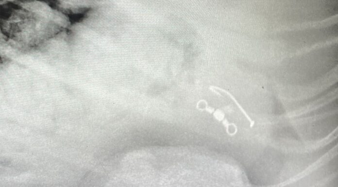 호주 시드니 야라나비 공원, 반려견 낚시 바늘 삼켜… 주민들 안전 대책 촉구 An X-ray shows the fishing hook in Ripley's stomach. (Supplied_9news)