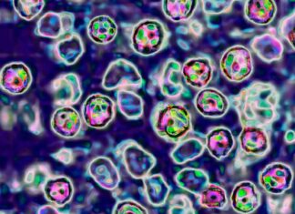 시드니 항공에 홍역 감염자 입국 NSW 보건 당국 경고 The measles virus, paramyxoviridae from the Morbillivirus family, transmission microscopy view. (BSIPUniversal Images GroupGettyCNN)