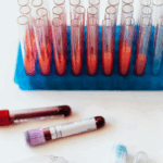 12.Early detection cancer tests are showing signs of promise, but some researchers still have reservations. Karolina Grabowska via Pexels