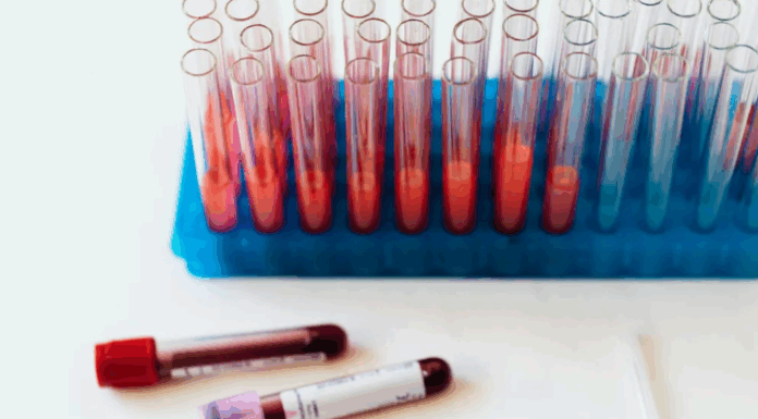 미국 혈액 속 암 DNA로 조기 발견 기술 연구 Early detection cancer tests are showing signs of promise, but some researchers still have reservations. Karolina Grabowska via Pexels