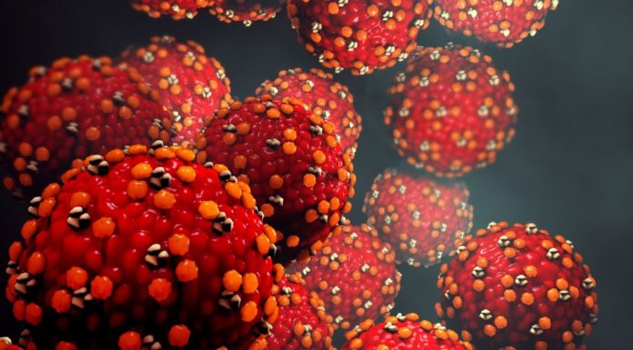 호주 퀸즐랜드·뉴사우스웨일스 홍역 확산 Queensland's measles outbreak has widened. (Getty)_9NEWS
