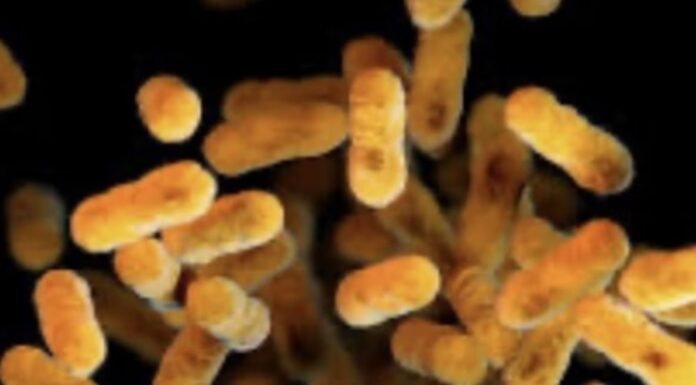 호주, 백일해 감염자 수 30년 만에 최고 기록 Australia has recorded its highest rates of whooping cough in three decades. Picture Wikimedia Commons_NEWS.COM.AU