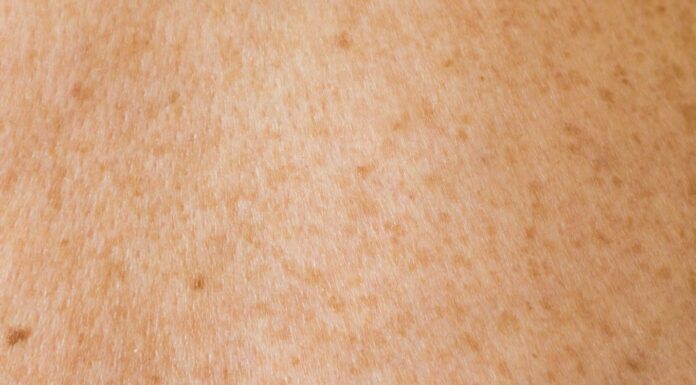 예방 가능한 암 중 호주인 발생율 높은 암은? Olga Thelavart_olga_o_unsplash