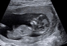 호주 여성 유산 상당수, 국가 공식 보건 통계서 전면 누락 Ms Walker is currently 17 weeks pregnant with a baby boy. Picture Supplied_news.com.au