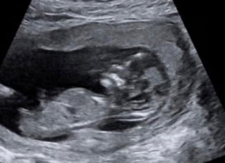 호주 여성 유산 상당수, 국가 공식 보건 통계서 전면 누락 Ms Walker is currently 17 weeks pregnant with a baby boy. Picture Supplied_news.com.au