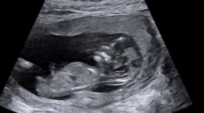 호주 여성 유산 상당수, 국가 공식 보건 통계서 전면 누락 Ms Walker is currently 17 weeks pregnant with a baby boy. Picture Supplied_news.com.au